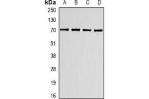 Western blot analysis of Lamin B Receptor expression in K562 (A), HT29 (B), mouse spleen (C), mouse lung (D) whole cell lysates. (Lamin B Receptor antibody)