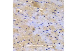 Immunohistochemistry of paraffin-embedded mouse heart using SGCE antibody.