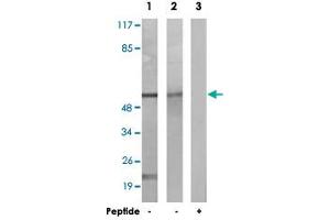 Western blot analysis of extracts from K-562 cells (Lane 1) and NIH/3T3 cells (Lane 2 and 3), using CAMK2A/CAMK2D polyclonal antibody .