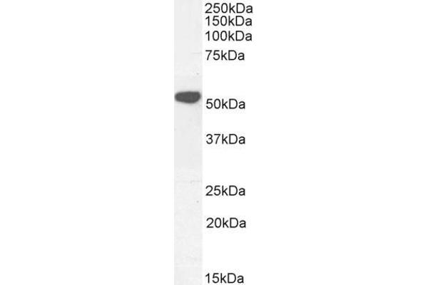 KATNAL2 antibody  (Internal Region)