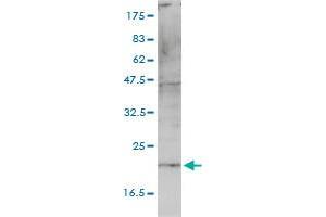 HSPC163 monoclonal antibody (M01), clone 4E10-1G4 Western Blot analysis of HSPC163 expression in A-431 . (CNIH4 antibody  (AA 1-139))