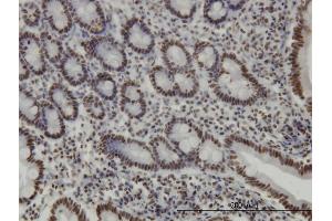 Immunoperoxidase of monoclonal antibody to TRIM28 on formalin-fixed paraffin-embedded human small Intestine. (KAP1 antibody  (AA 379-524))