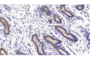 Immunohistochemistry (IHC) image for anti-ATG16 Autophagy Related 16-Like 1 (ATG16L1) (AA 342-607) antibody (ABIN7443884)