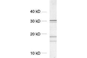 dilution: 1 : 5000, sample: crude synaptosomal fraction of rat brain (P2) (Clathrin antibody  (AA 156-173))