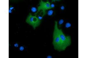 Anti-MTMR14 mouse monoclonal antibody (ABIN2453332) immunofluorescent staining of COS7 cells transiently transfected by pCMV6-ENTRY MTMR14 (RC207732). (MTMR14 antibody)