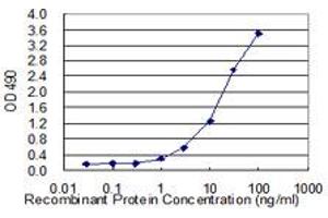 SERPINB1 (Human) Matched Antibody Pair