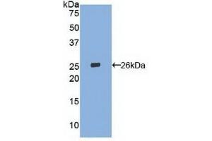 Detection of Recombinant LOX1, Human using Polyclonal Antibody to Lectin Like Oxidized Low Density Lipoprotein Receptor 1 (LOX1) (OLR1 antibody  (AA 81-273))