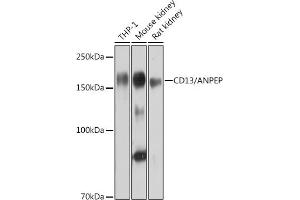 Western blot analysis of extracts of various cell lines, using CD13/ANPEP Rabbit mAb (ABIN7265525) at 1:1000 dilution.