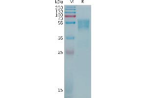 Human CD55 Protein, His Tag on SDS-PAGE under reducing condition.