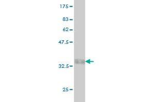 Western Blot detection against Immunogen (37. (GUCA1B antibody  (AA 93-200))