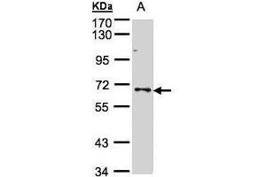WB Image Sample(30 μg of whole cell lysate) A:A431, 7. (SHP1 antibody  (Center))