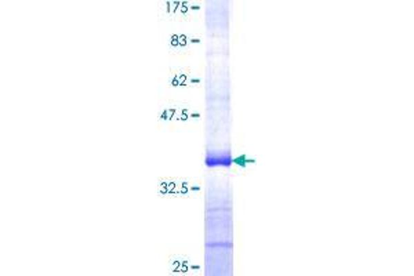 SPOCK3 Protein (AA 132-230) (GST tag)