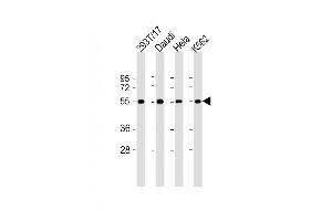 All lanes : Anti-B7H6 Antibody (C-term) at 1:2000 dilution Lane 1: 293T/17 whole cell lysate Lane 2: Daudi whole cell lysate Lane 3: Hela whole cell lysate Lane 4: K562 whole cell lysate Lysates/proteins at 20 μg per lane. (B7-H6 antibody  (C-Term))