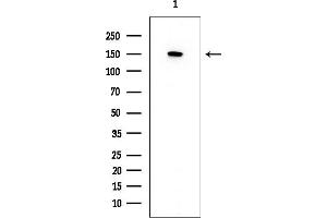 anti-ATP-Binding Cassette, Sub-Family C (CFTR/MRP), Member 1 (ABCC1) (N-Term) antibody