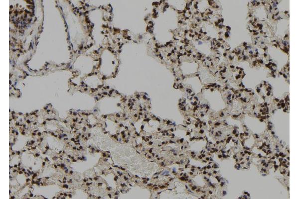 CEP164 antibody  (C-Term)