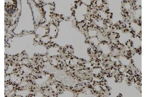 ABIN6273097 at 1/100 staining Rat lung tissue by IHC-P. (CEP164 antibody  (C-Term))