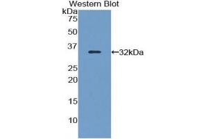 WB of Protein Standard: different control antibodies against Highly purified E. (FLNB ELISA Kit)