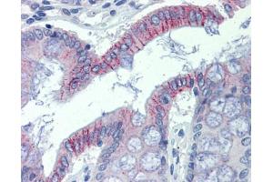 Immunohistochemistry (IHC) image for anti-Desmoglein 2 (DSG2) (N-Term) antibody (ABIN2782147) (Desmoglein 2 antibody  (N-Term))
