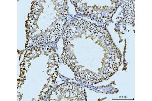 IHC analysis of SBNO1 using anti-SBNO1 antibody (ABIN7601710).