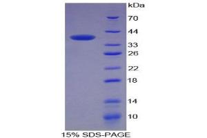 SDS-PAGE (SDS) image for Keratin 4 (KRT4) (AA 152-457) protein (His tag) (ABIN1878870)