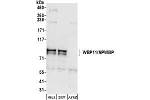 anti-WW Domain Binding Protein 11 (WBP11) (AA 200-250) antibody