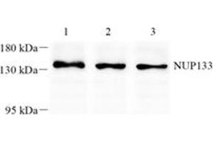 Western blot analysis of NUP133 (ABIN7074909) at dilution of 1: 1000,Lane 1: K562 cell lysate,Lane 2: 293 cell lysate,Lane 3: A375 cell lysate (NUP133 antibody)