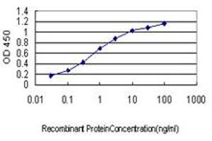 Detection limit for recombinant GST tagged CDC42BPA is approximately 0. (CDC42BPA antibody  (AA 551-650))