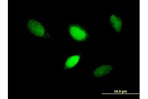 Immunofluorescence of purified MaxPab antibody to T on HeLa cell. (T Brachyury Protein (AA 1-377) antibody)