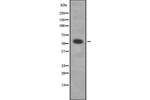Western blot analysis of ADRA1D using K562 whole cell lysates