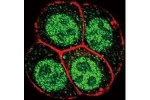Confocal immunofluorescent analysis of phospho-SMAD2 antibody with HeLa cells followed by Alexa Fluor 488-conjugated goat anti-rabbit lgG (green). (SMAD2 antibody  (pSer118))