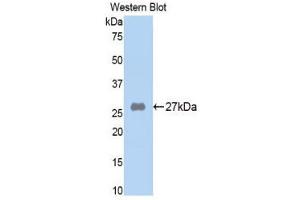 Western Blotting (WB) image for anti-alpha-2-Macroglobulin (A2M) (AA 818-1048) antibody (ABIN1857845) (alpha 2 Macroglobulin antibody  (AA 818-1048))