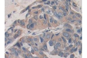 Immunohistochemistry (IHC) image for anti-SHC (Src Homology 2 Domain Containing) Transforming Protein 3 (SHC3) (AA 188-433) antibody (ABIN7443536)