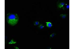 Immunofluorescence staining of MCF-7 cells with ABIN7163836 at 1:100, counter-stained with DAPI. (PKD2 antibody  (AA 680-968))