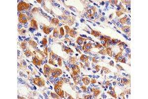 IHC testing of FFPE human stomach with PACSIN2 antibody at 1:100.
