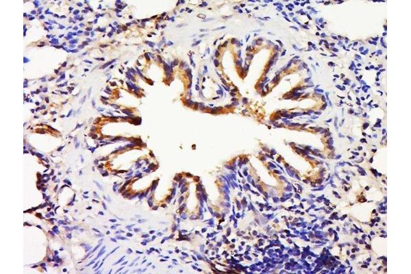 FTSJ1 antibody  (AA 1-110)