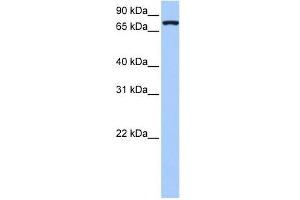 NLGN4X antibody used at 1 ug/ml to detect target protein. (Neuroligin 4 antibody  (Middle Region))