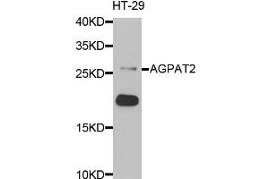 Western blot analysis of extracts of HT-29 cells, using AGPAT2 antibody.