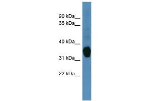 WB Suggested Anti-AKR1C1 Antibody Titration: 0. (AKR1C1 antibody  (N-Term))