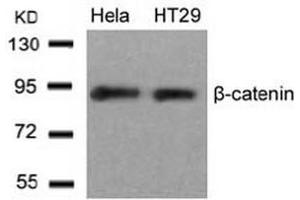 Image no. 3 for anti-Catenin (Cadherin-Associated Protein), beta 1, 88kDa (CTNNB1) (Ser33) antibody (ABIN197444) (CTNNB1 antibody  (Ser33))