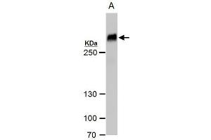 WB Image Filamin B antibody [N1], N-term detects Filamin B protein by western blot analysis.