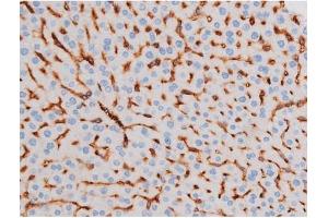 Immunohistochemistry (IHC) image for anti-Insulin Receptor Substrate 1 (IRS1) (pSer312) antibody (ABIN6256264)