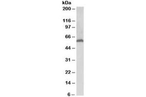 Western blot testing of human liver lysate with 58K Golgi protein antibody at 0. (FTCD antibody)
