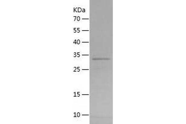 Peroxidasin Protein (AA 595-702) (His-IF2DI Tag)