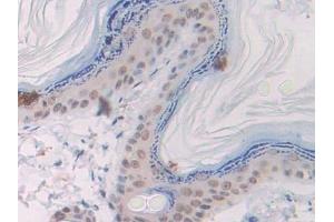 Detection of Slit1 in Rat Skin Tissue using Polyclonal Antibody to Slit Homolog 1 (Slit1) (SLIT1 antibody  (AA 308-512))