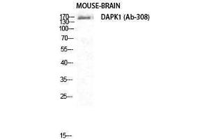 Western Blotting (WB) image for anti-Death-Associated Protein Kinase 1 (DAPK1) (Ser296) antibody (ABIN3174707) (DAP Kinase 1 antibody  (Ser296))