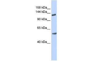 Western Blotting (WB) image for anti-Roundabout, Axon Guidance Receptor, Homolog 2 (ROBO2) antibody (ABIN2458930) (ROBO2 antibody)