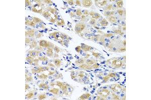 Immunohistochemistry of paraffin-embedded human gastric using SPATA4 antibody at dilution of 1:100 (x40 lens).