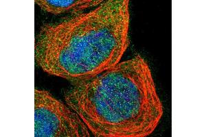 Immunofluorescent staining of human cell line A-431 shows localization to nucleoplasm, cytosol & centrosome. (SMAD4 antibody  (AA 118-240))