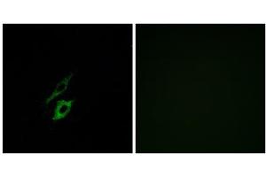 Immunofluorescence analysis of A549 cells, using FPR1 antibody. (FPR1 antibody  (Internal Region))