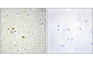 Immunohistochemistry analysis of paraffin-embedded human brain tissue, using DNL1 Antibody. (DNASE1 antibody  (AA 111-160))